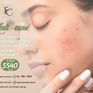 Facial Anti-acné