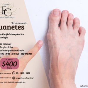 Tratamiento Juanetes